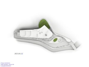 SITE_PLAN